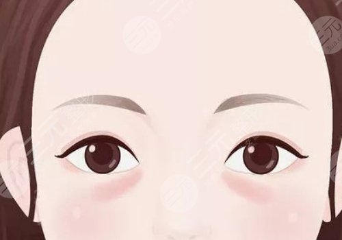 脂肪填充淚溝5到10天照片案例分享來(lái)啦