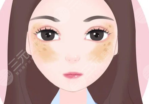 鐳射凈膚儀祛斑一次有效果嗎