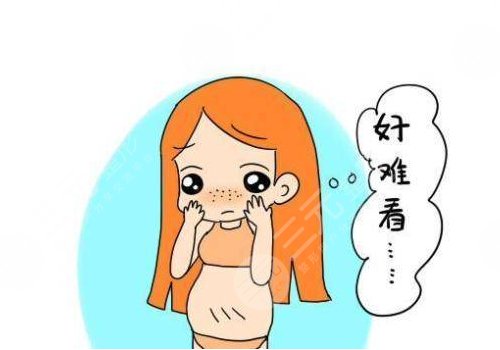 妊娠紋什么時(shí)候開(kāi)始出現(xiàn)