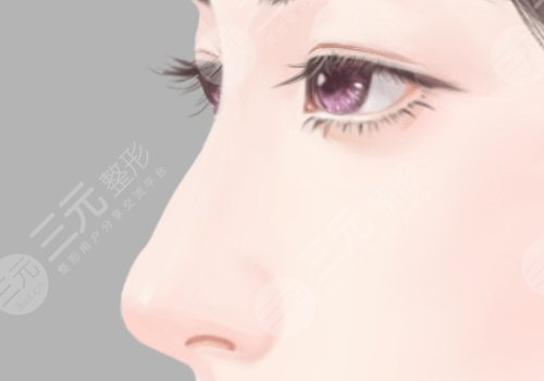 湖南省人民醫(yī)院李高峰鼻子做的怎么樣