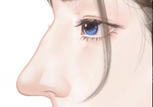 湖南省人民醫(yī)院李高峰鼻子做的怎么樣