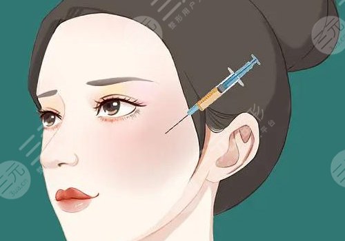 輪廓填充需要打**不