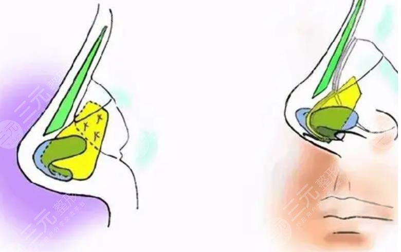 北京美萊醫(yī)療美容醫(yī)院擅長項目