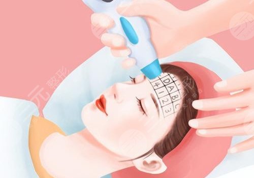 去色素斑用什么藥膏好？