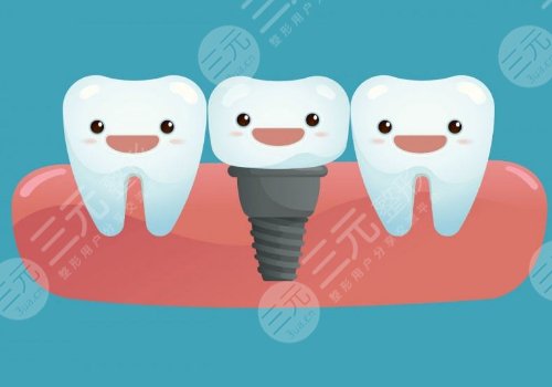 北京安貞醫(yī)院口腔科種植牙怎么樣