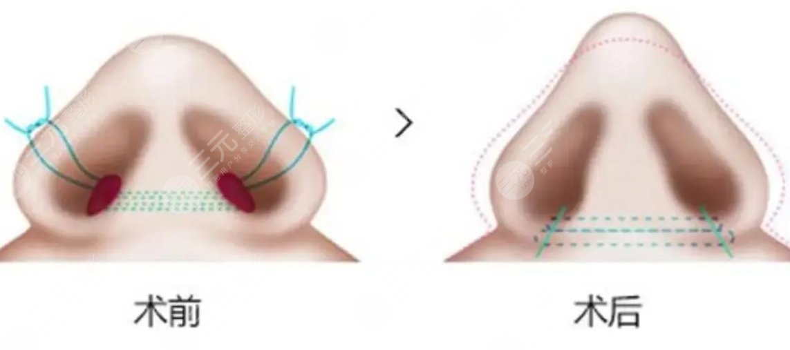 華西醫(yī)院整形科價(jià)目表新2023