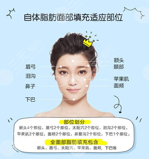 余恩旭脂肪填充怎么樣?