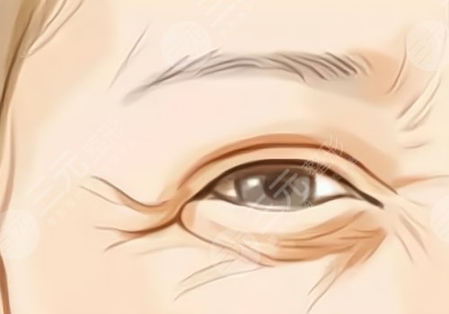 眼部拉皮手術(shù)后會有哪些后遺癥