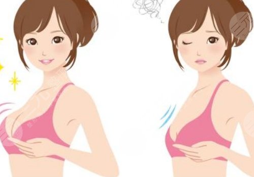 傲諾拉和曼托的區(qū)別在哪里