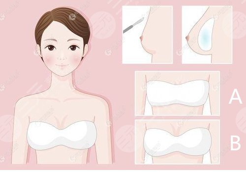 傲諾拉和曼托的區(qū)別在哪里