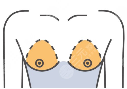 傲諾拉和曼托的區(qū)別在哪里