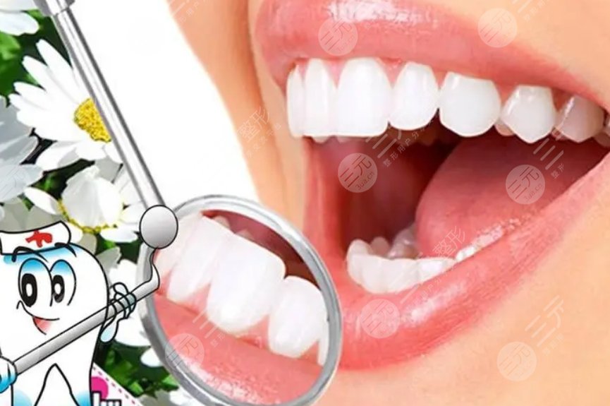 牙齒美白