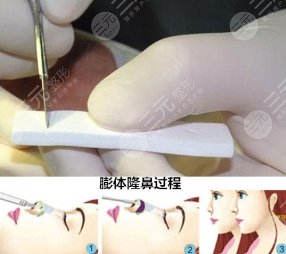 廣州藝美做鼻子做得好嗎