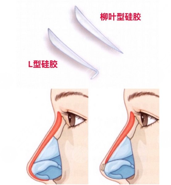 上海華美醫(yī)療美容醫(yī)院特色項(xiàng)目