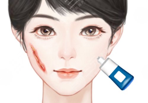 上海兒童醫(yī)學(xué)中心整形科哪個醫(yī)生好