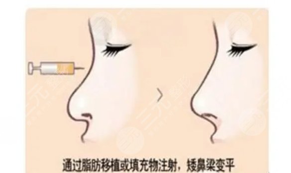 上海華美醫(yī)療美容醫(yī)院擅長(zhǎng)項(xiàng)目