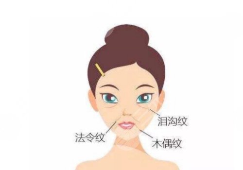 鼻唇溝和法令紋的區(qū)別