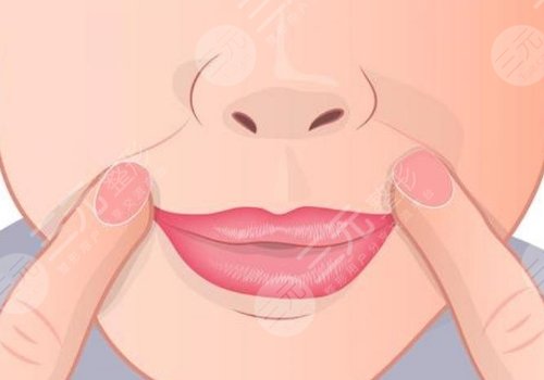 鼻唇溝和法令紋的區(qū)別