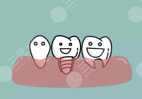 昭通西南博大口腔醫(yī)院牙齒矯正怎么樣