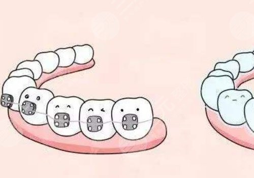 昭通西南博大口腔醫(yī)院牙齒矯正多少錢？怎么樣？