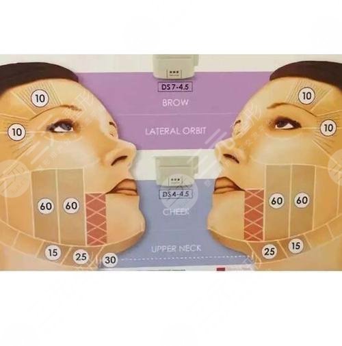 鼻唇溝和法令紋的區(qū)別