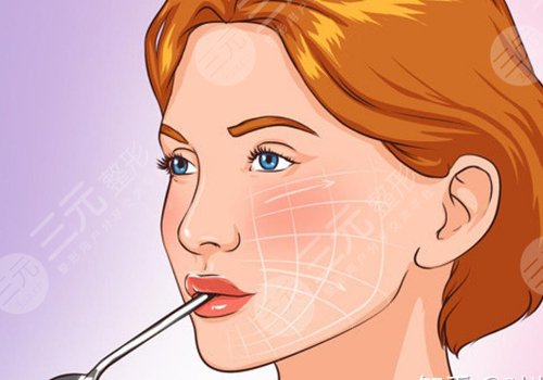 7d聚拉提做一次效果維持多久