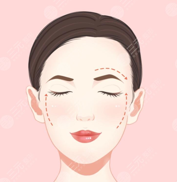 女人做拉皮能管多少年?皮膚科醫(yī)生透露通常維持時間為3~5年左右