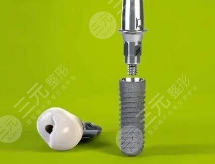 上海長(zhǎng)海醫(yī)院種牙多少錢(qián)?