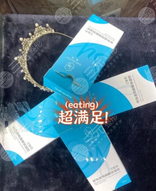 馨妍玻尿酸可以維持多久？注射專家告知通常能保持8~12個(gè)月左右