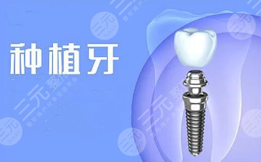 半口牙齒種植好不好?