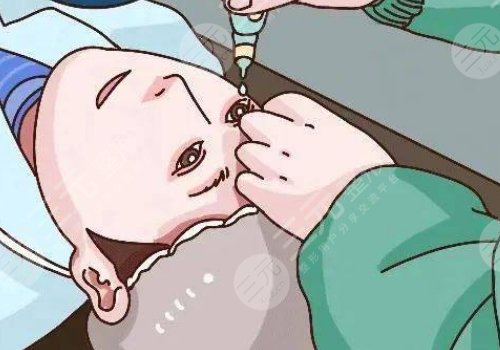 近視手術(shù)多少錢