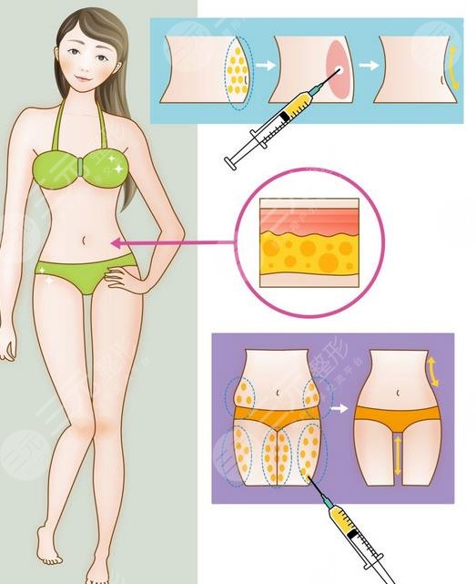 上海八院整形美容科特色項(xiàng)目