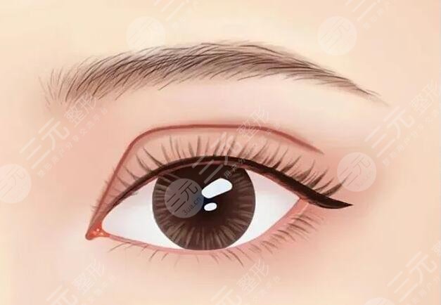 南京鼓樓醫(yī)院譚謙割雙眼皮怎么樣多少錢？?jī)r(jià)格發(fā)布及醫(yī)生資料實(shí)力