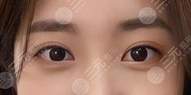 肖貴喜醫(yī)生做雙眼皮怎么樣啊？醫(yī)生個(gè)人實(shí)力測(cè)評(píng)，就職醫(yī)院是哪家？