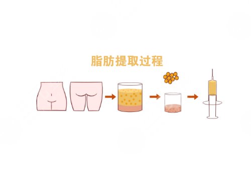 鄭州楊麗美顏做雙眼皮怎么樣