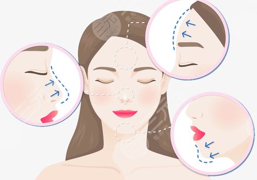 輪廓固定怎么做