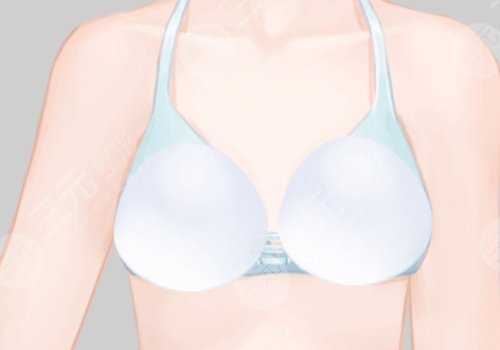 哺乳后的胸怎么恢復(fù)彈性