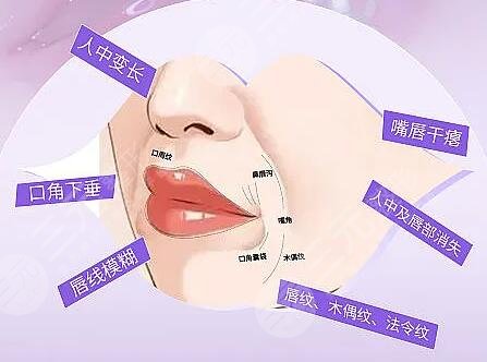 人工韌帶提升面部下垂安全嗎？多久能恢復(fù)？效果可以維持多長(zhǎng)時(shí)間？