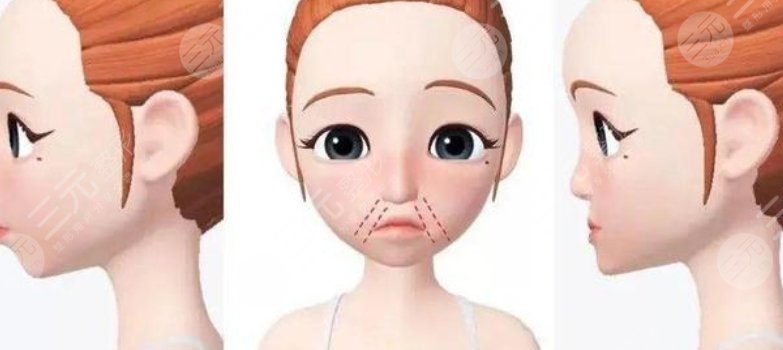 幼態(tài)臉整形案例