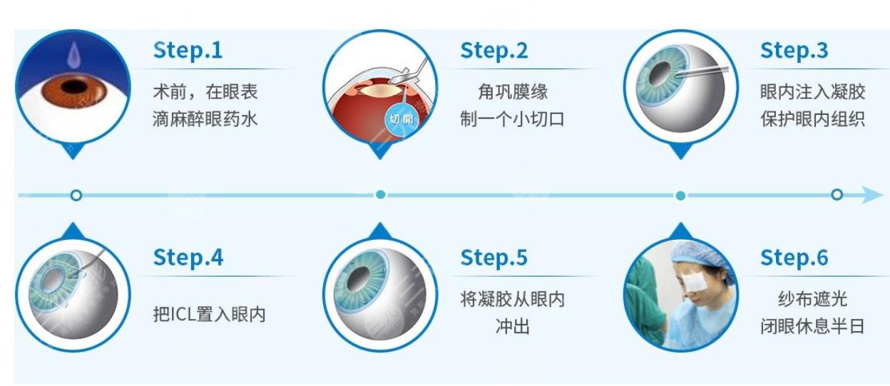 上海第九人民醫(yī)院眼科專家