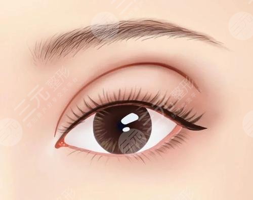 龍崗人民醫(yī)院何赤東雙眼皮技術怎么樣