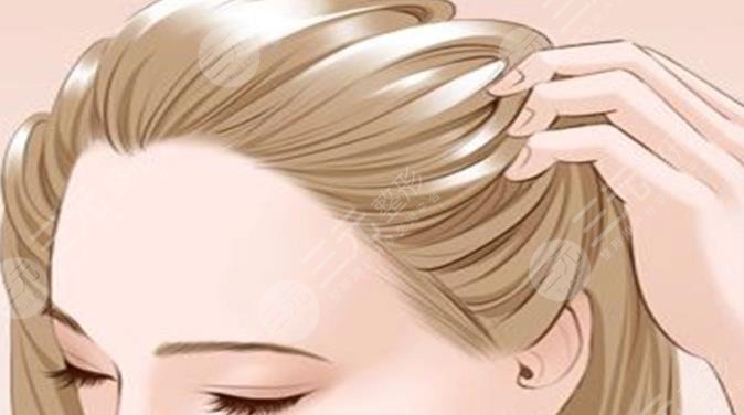 發(fā)際線種植