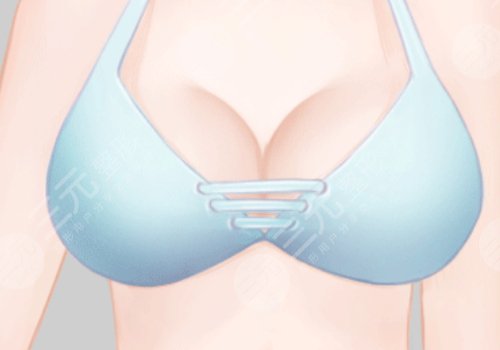 如何乳房變大變挺