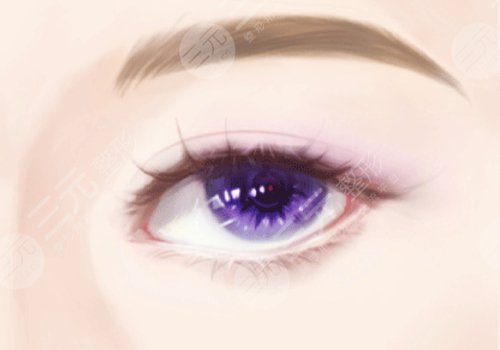 顧勤浩雙眼皮案例