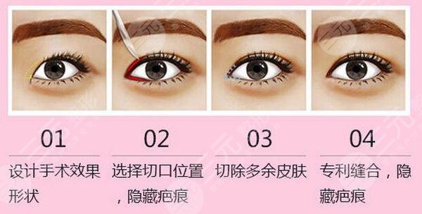 中山三院趙卉怎么樣