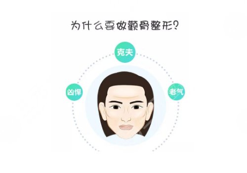 上海第九人民醫(yī)院顴骨內(nèi)推手術(shù) 