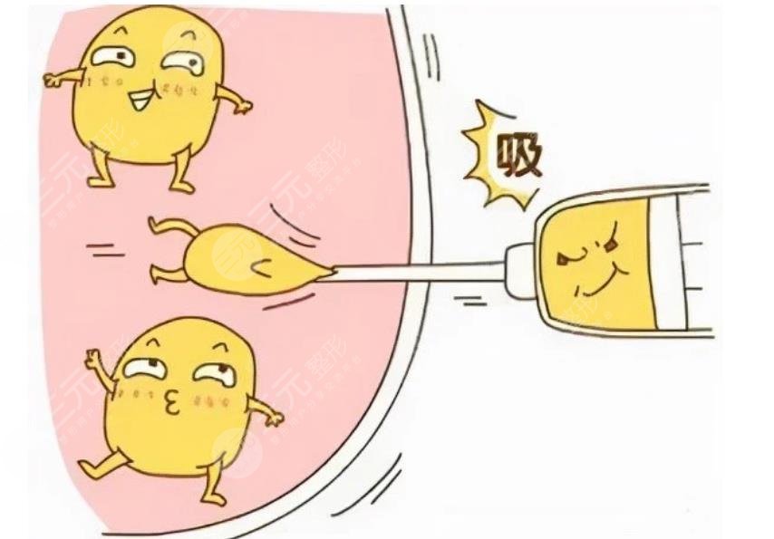 鄭博晨醫(yī)生抽脂案例