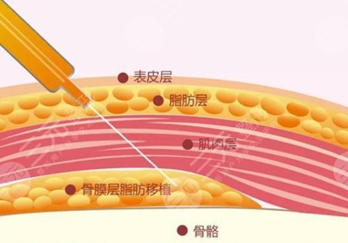 深圳北大醫(yī)院隆胸做得怎么樣