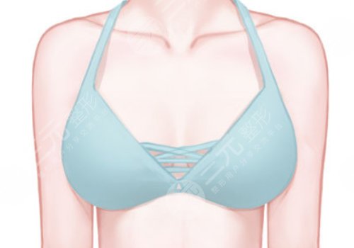 樂山人民醫(yī)院縮胸手術費用