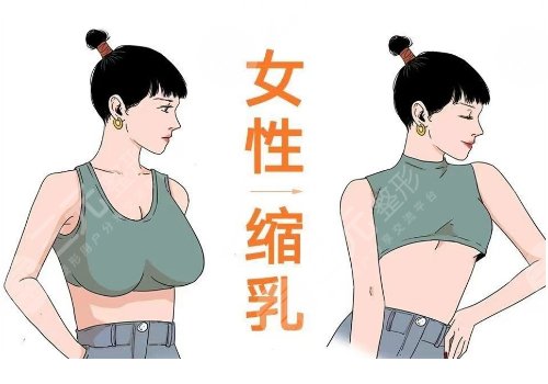 海南西部中心醫(yī)院縮胸手術(shù)費(fèi)用